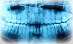 radiodental